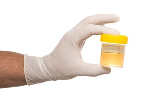 URYNOTERAPIA PROSTYM SPOSOBEM NA ZDROWIE?' Blog